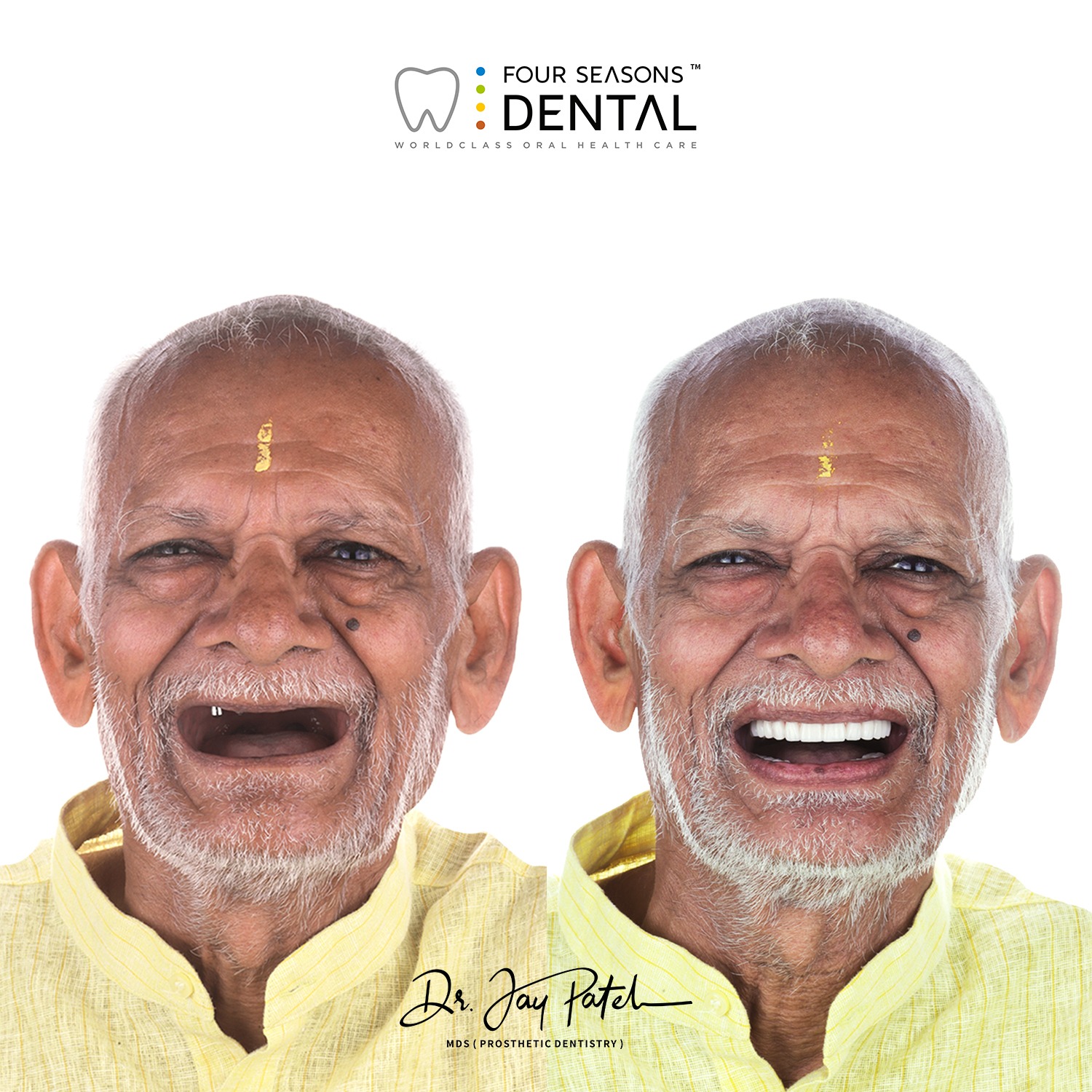 Extra Oral